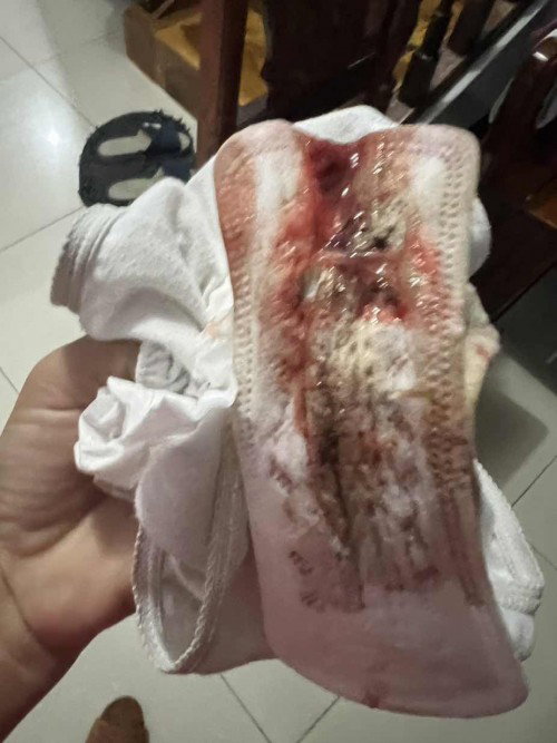 Dapat na ba akong pumunta sa OSPITAL 40 weeks pregnant
