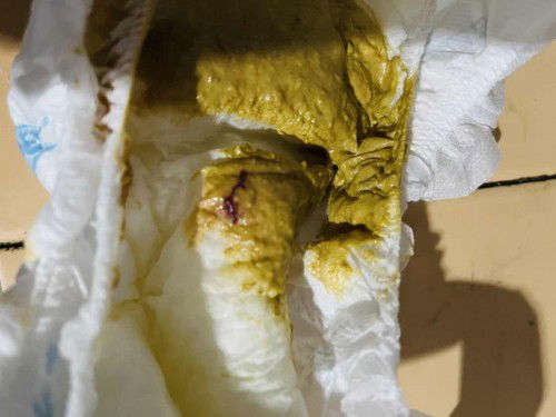 Najis bayi lendir coklat