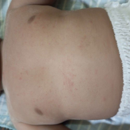 Badan bintik² merah