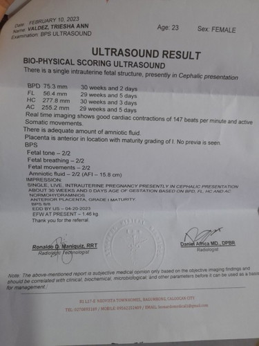 Mga mi okay lang po ba laki ng baby ko last check up ko feb 10, 1.46kg lang po sya