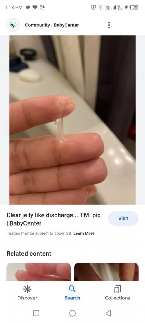 Clear Jelly Discharge