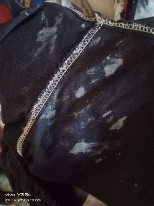 ตกขาวไหลเยอะผิดปกติไหมคะ