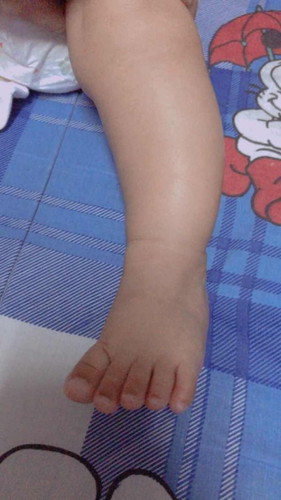 สอบถามแม่ๆค่ะ