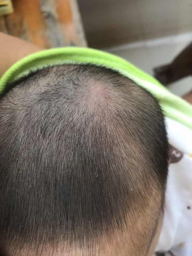 อุ้มลูกชนเหลี่ยมประตู