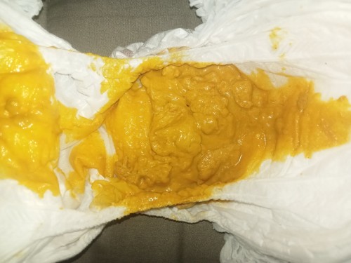 น้องไม่ถ่าย8วัน