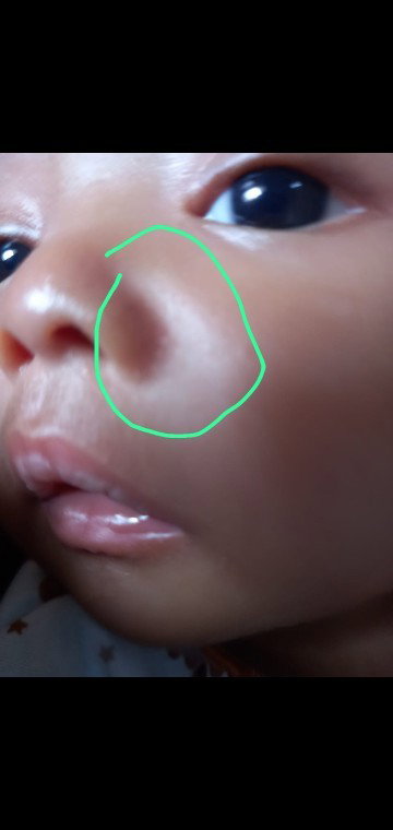 Wajah dan leher ada putih putihny