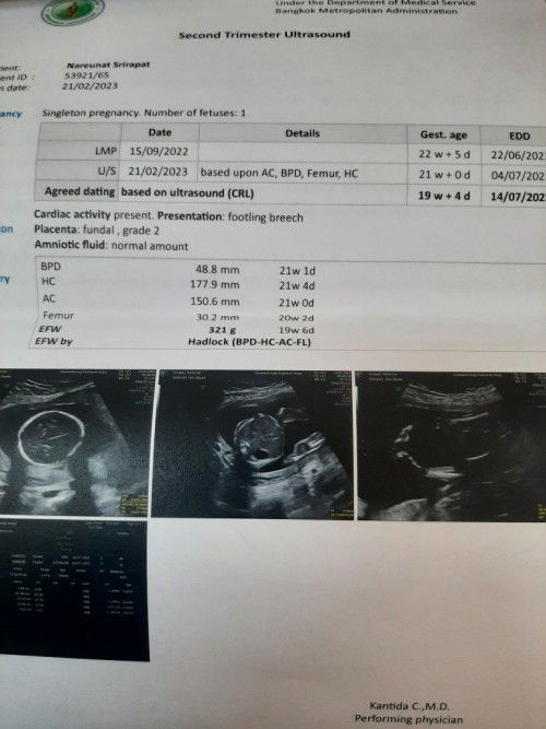 อัลตร้าซาว19w4dมีโอกาศผิดพลาดไหมคะ