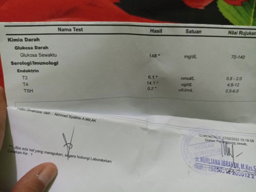 Hypertiroid pada ibu hamil