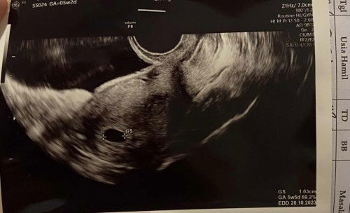 ke obgyn pertama kali🥰