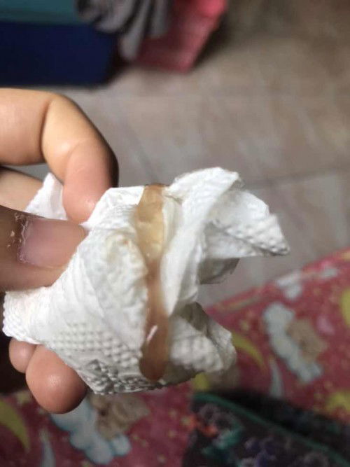 มูกเลือดออกอยากทราบวันคลอด