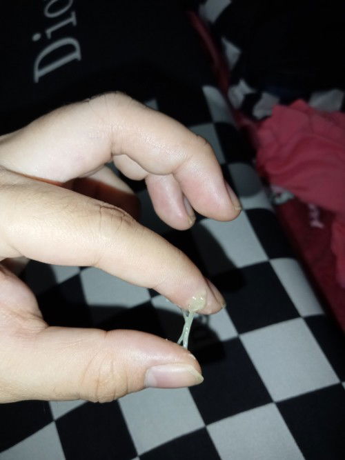 Mucus plug napo ba ito 36weeks and 4days napo ako Bali 2cm napo ako