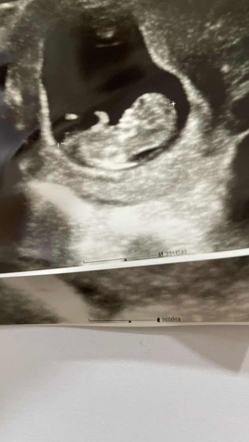 Bun adakah yang harus cek NIPT disini?