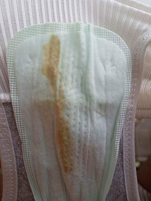 ท้อง20weekแต่มีคล้ายๆเลือดติดแคร์ฟรี