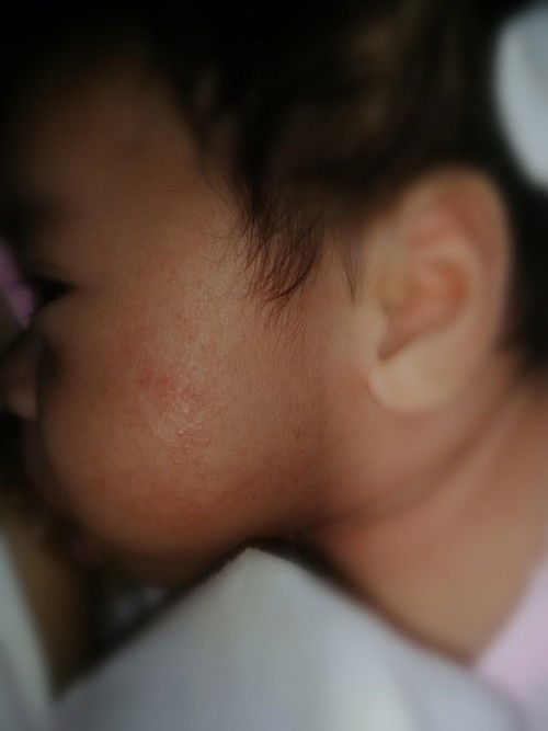 Hello po mga mommy, tanong lang po ano kaya ito at possible na gamot nito para sa 2 months old. t. y