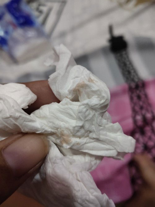 Usia kandungan 39week keluar flek darah sedikit