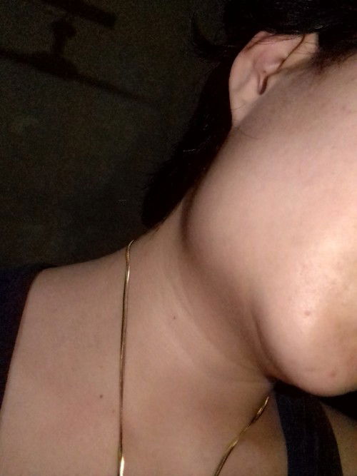 Tonsillitis stone while pregnant. 😔