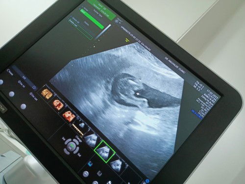 ดูให้หน่อยค้ะเพศไหน