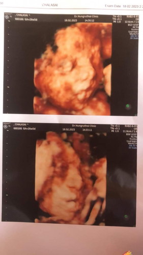 เตรียมของใช้ลูก