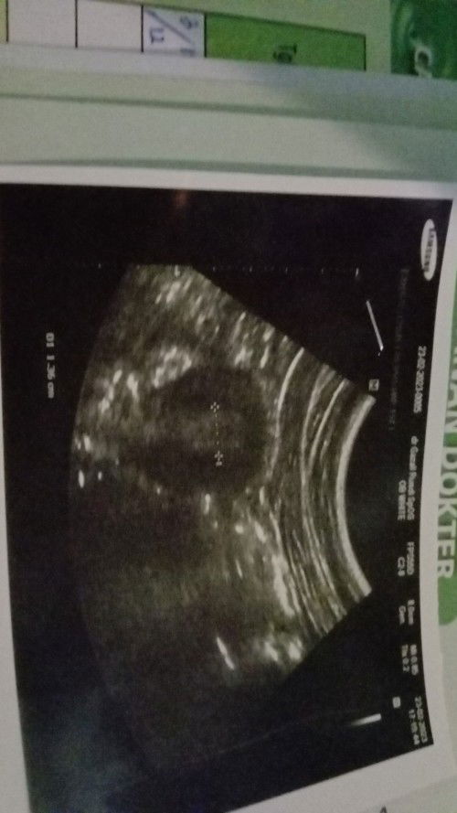 Apakah bunda pernah mengalaminya