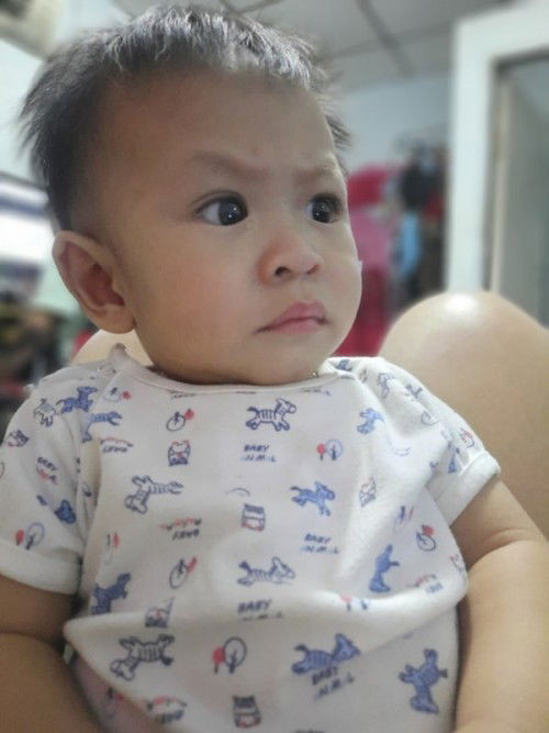 มีรูเล็กๆอยู่บริเวณหัวตาลูก