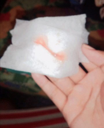 Bloody show (5:51am) Mocus Plug (11:15am)