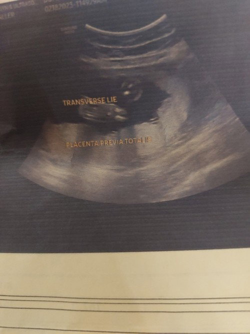 Hello mga momshie, sino naka try na may placenta previa at 24 weeks? Pa share po.salamat