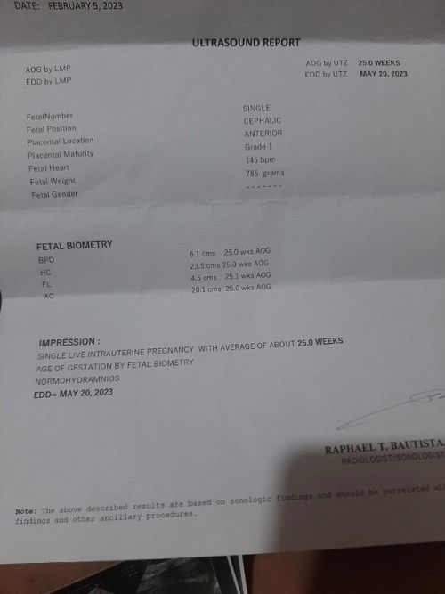 Survey lang po excited po eh.😁