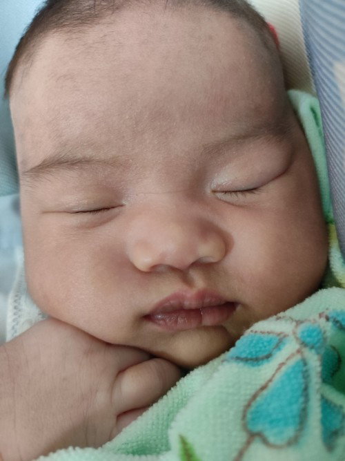 ลูกริมฝีปากคล้ำ