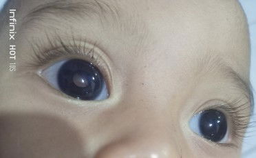 Hati rasanya hancur liat mata anak seperti ini, gtau harus apa yg di lakukan kedepannya 😫😫😫😫😫