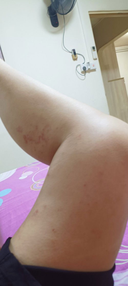 I would like to ask as I don't know what is happening to my leg can anyone tell me what I can do?