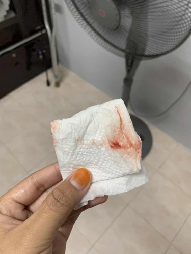 spotting or bleeding
