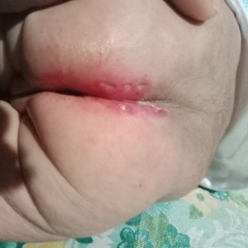 Ano po bang tawag dito ? Diko kase alam kung ano yan e . Thankyou po s sasagot