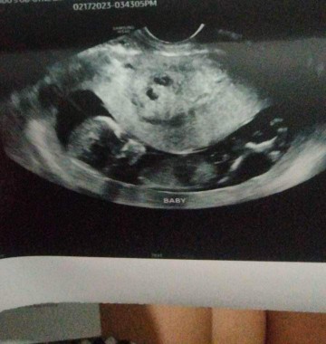 13weeks preggy #firstime mom