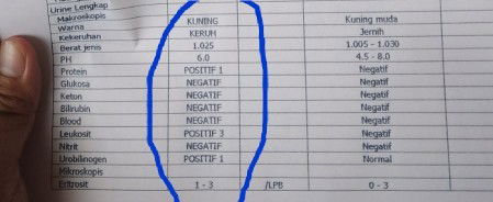 HASIL LAB URINE