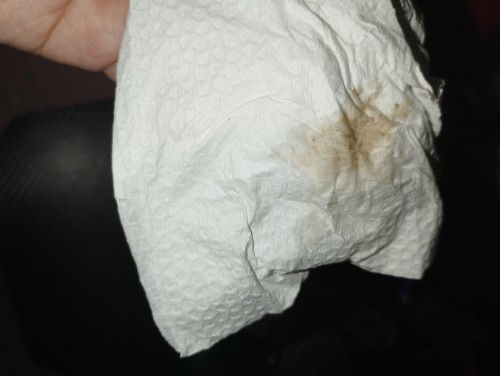 Spotting (22wks preggy)