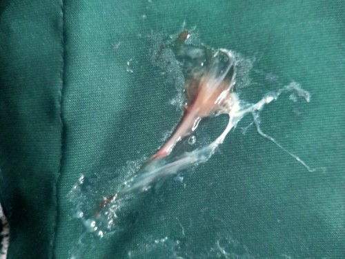 Keluar flek saat hamil 39week4hari