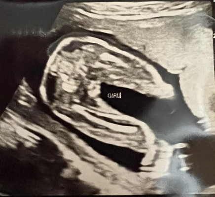 Gender scan