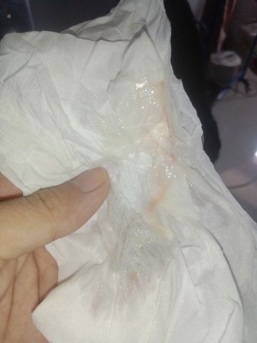 สอบถามแม่ๆคะ เมื่อวันจันทร์ปากมดลูกเปิด2เซน