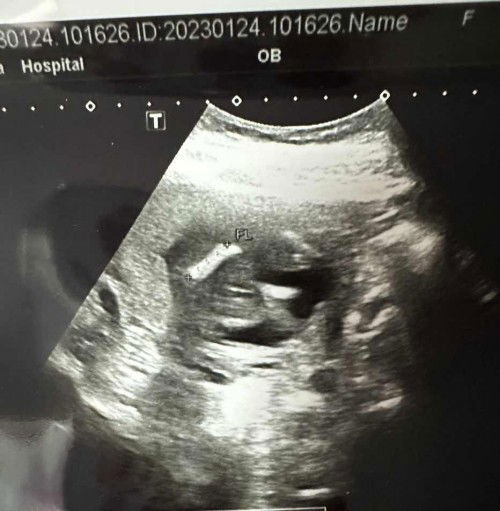 สอบถามแม่ๆผู้มีประสบการณ์ค่ะ