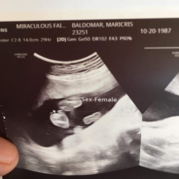 tanong lang po baby girl po ba talaga, .kasi sabi ng nag ultrasound sakin 80% babae