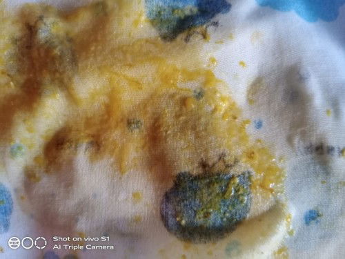 ขอสอบถามหน่อยค่ะ อึแบบนี้ปกติไหมคะ น้อง2เดือนกว่าๆค่ะ