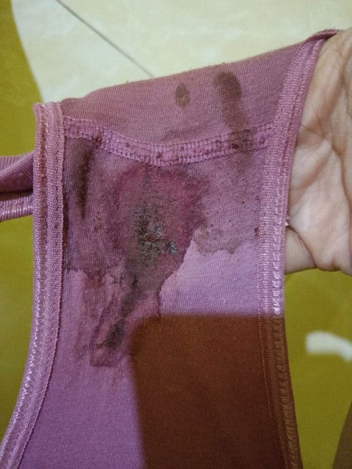 28week keluar bercak darah ( jangan dibuka kalo jijik)
