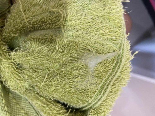 ท้อง36 w5  แบบนี้คือมูกหรือตกขาวค่ะ