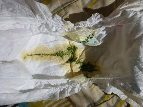 Green poop