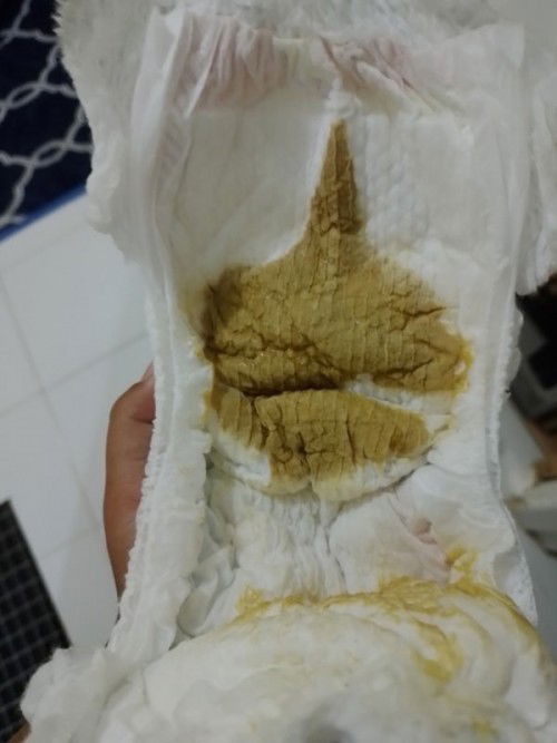 Warna pup bayi seperti ini apakah normal?