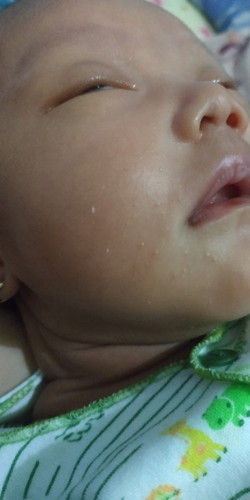 Bintik putih di pipi