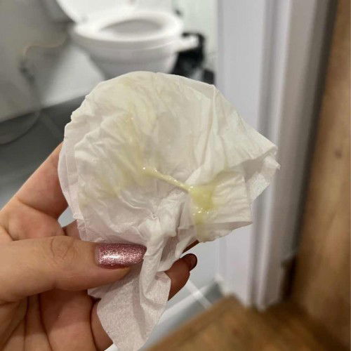 สอบถามค่ะ แบบนี้เป็นมูกหรือตกขาวธรรมดาค่ะ ไม่มีอาการเจ็บท้องอะไรเลย ควรไปหาหมอมั้ยคะ 37week