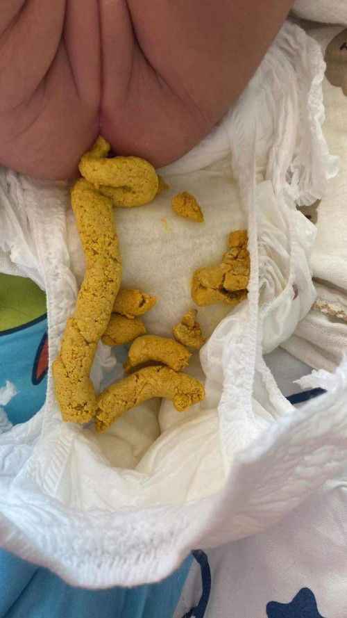 ลองกินนมผงแล้วอึเหมือนมีความแข็งบ้างและอ่อน ผสม ปกติไหมค่ะ หรือว่าอึควรเหลวมากกว่านี้ถึงจะปกติ?