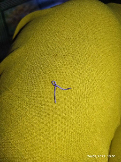 Benang jahit lahiran putus.