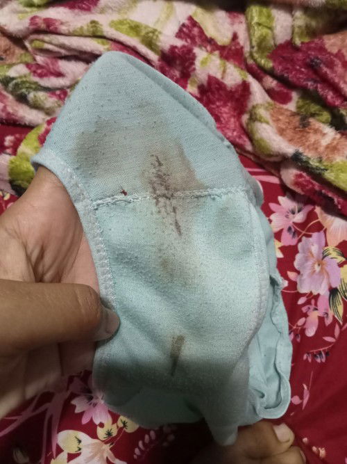 Bund maaf ya sedikit jorok tapi saya kpikiran jadi keramen keluar flek coklat gak banyak saya bedres